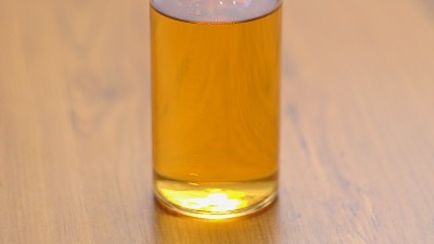 加酶洗衣粉中添加的是什么酶制劑